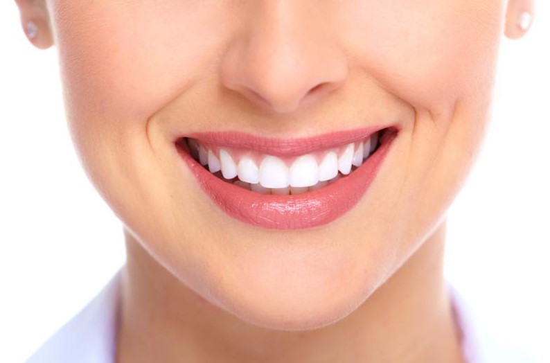 Benefits of Dental Implants