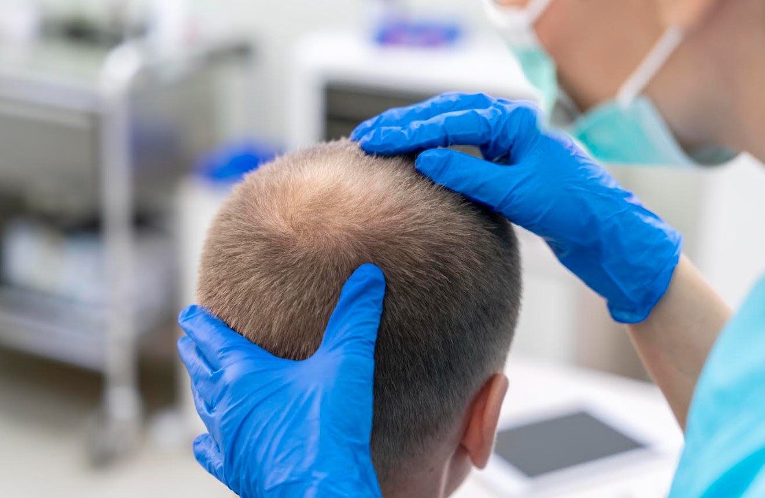The Secret to Understanding Hair Loss and its Treatments